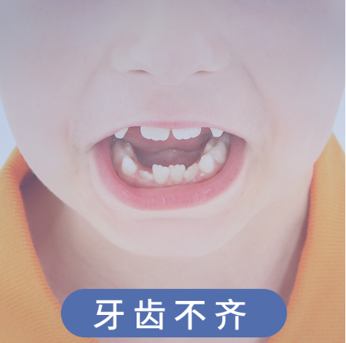 牙齿不齐